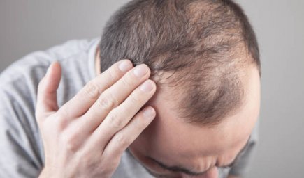 Hair Loss Treatment Solutions for Improving Hair Strength and Volume Hair Loss Treatment Solutions for Improving Hair Strength and Volume