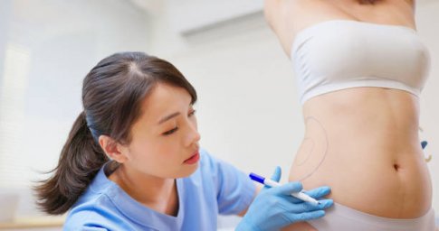 Liposuction Guide to Improving Body Shape Naturally Liposuction Guide to Improving Body Shape Naturally