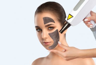 Spectra Laser Carbon Peel for Smoother and Softer Looking Skin Spectra Laser Carbon Peel for Smoother and Softer Looking Skin