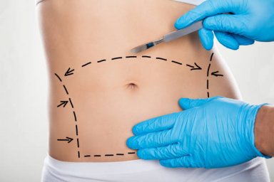 Fat Melting Injections for Supporting a More Streamlined Body Profile Fat Melting Injections for Supporting a More Streamlined Body Profile