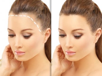 Hair Transplant Guide for Understanding Hair Restoration