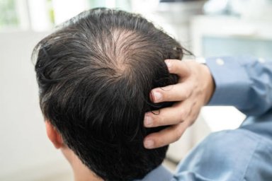 Understanding the Science Behind PRP Hair Treatment for Hair Growth