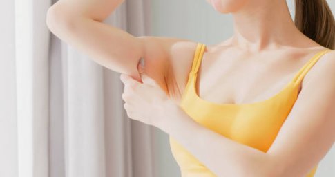 Arm Lift Surgery and Its Impact on Your Body Confidence